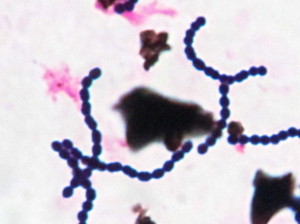 Streptococcus-dysagalactiae-BC2