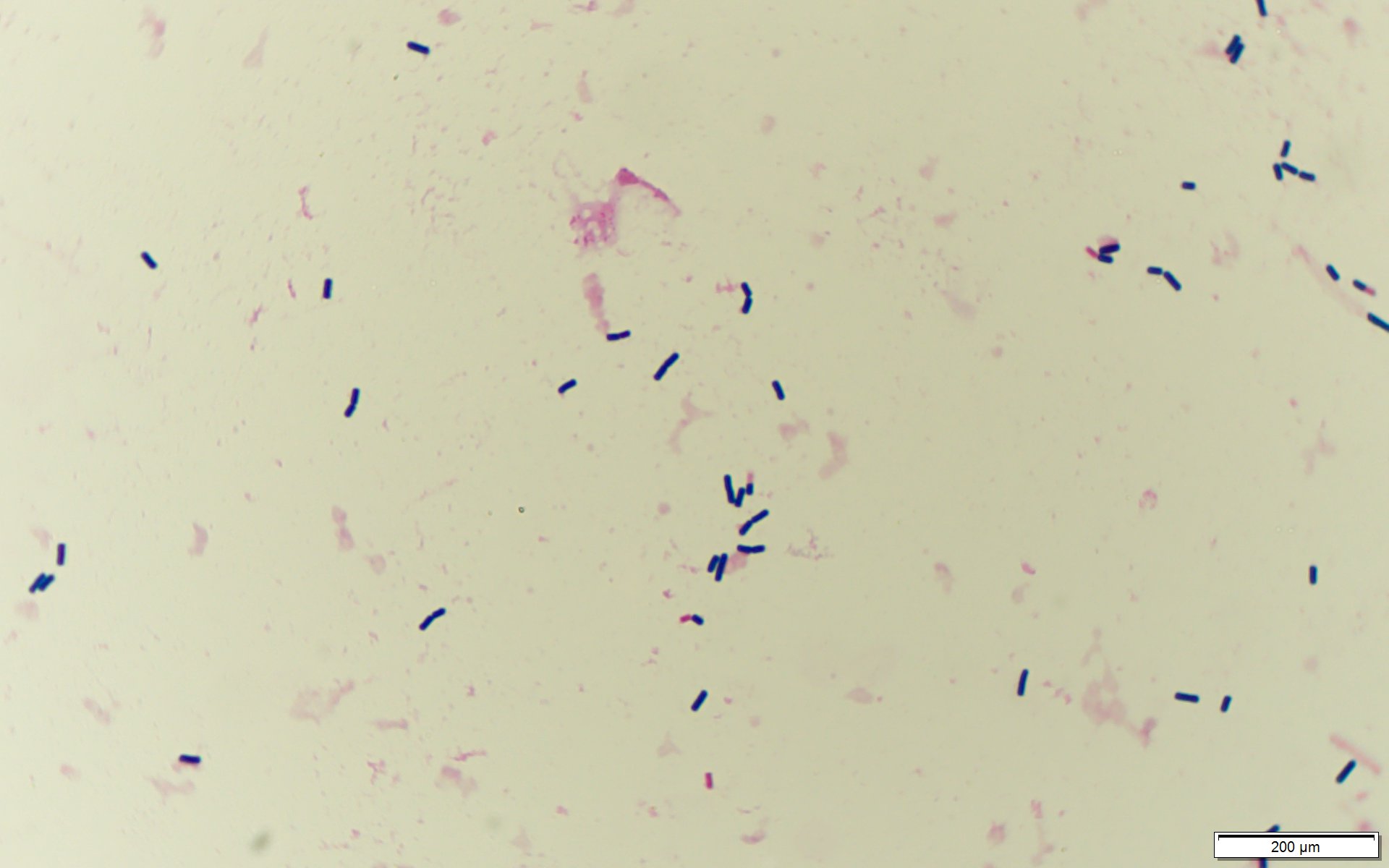 Bacillus cereus〔セレウス菌〕