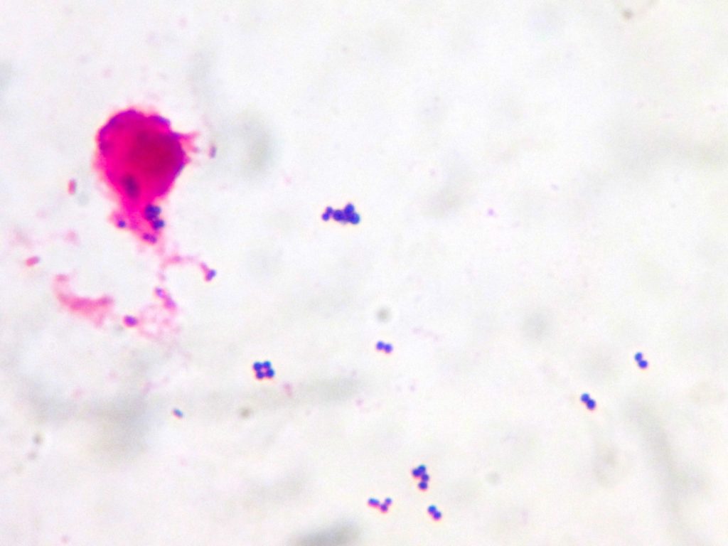 Enterococcus feacium〔腸球菌〕