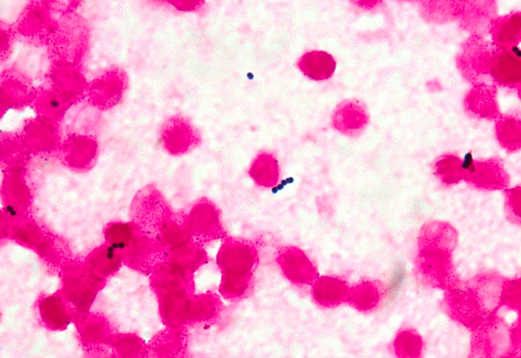 Enterococcus feacium〔腸球菌〕