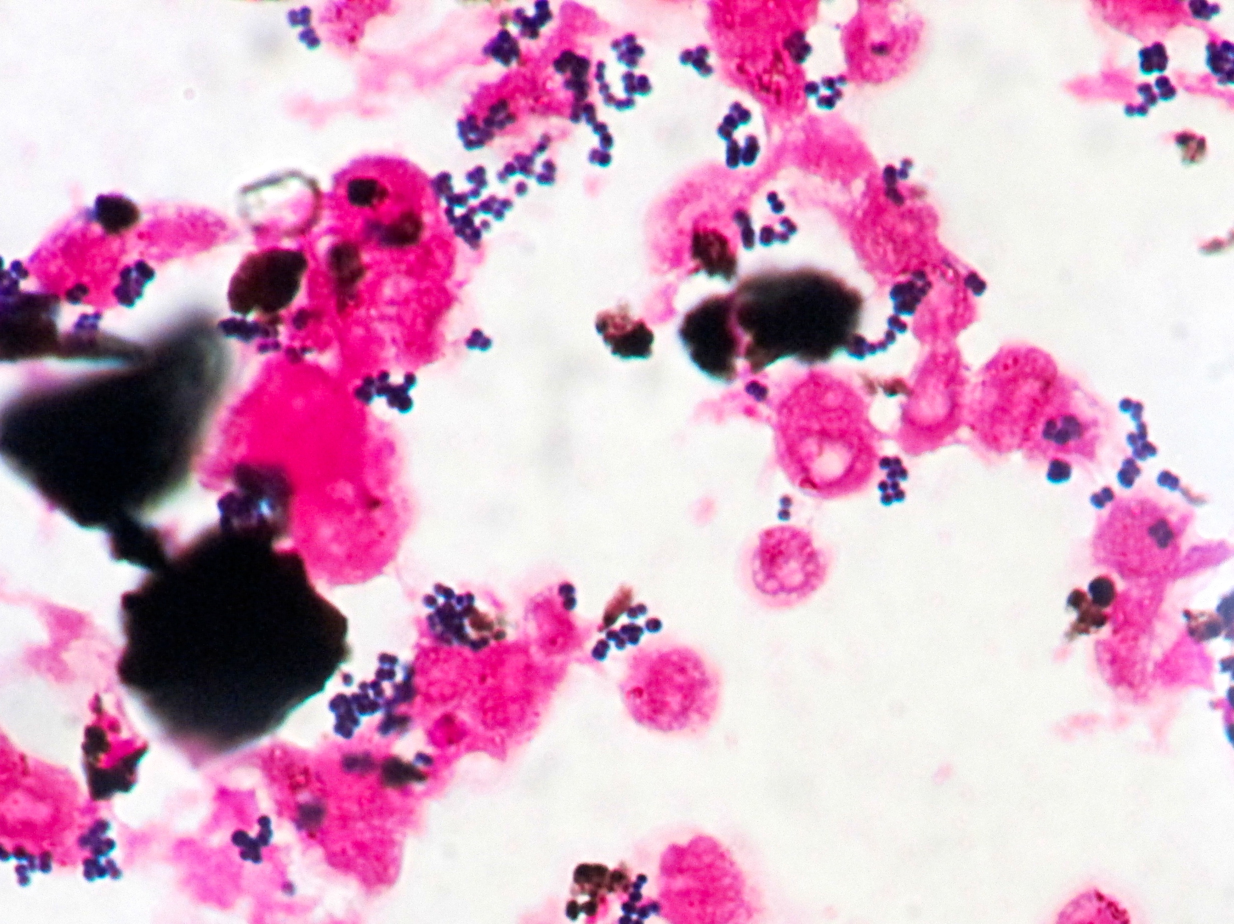 Staphylococcus epidermidis〔表皮ブドウ球菌〕