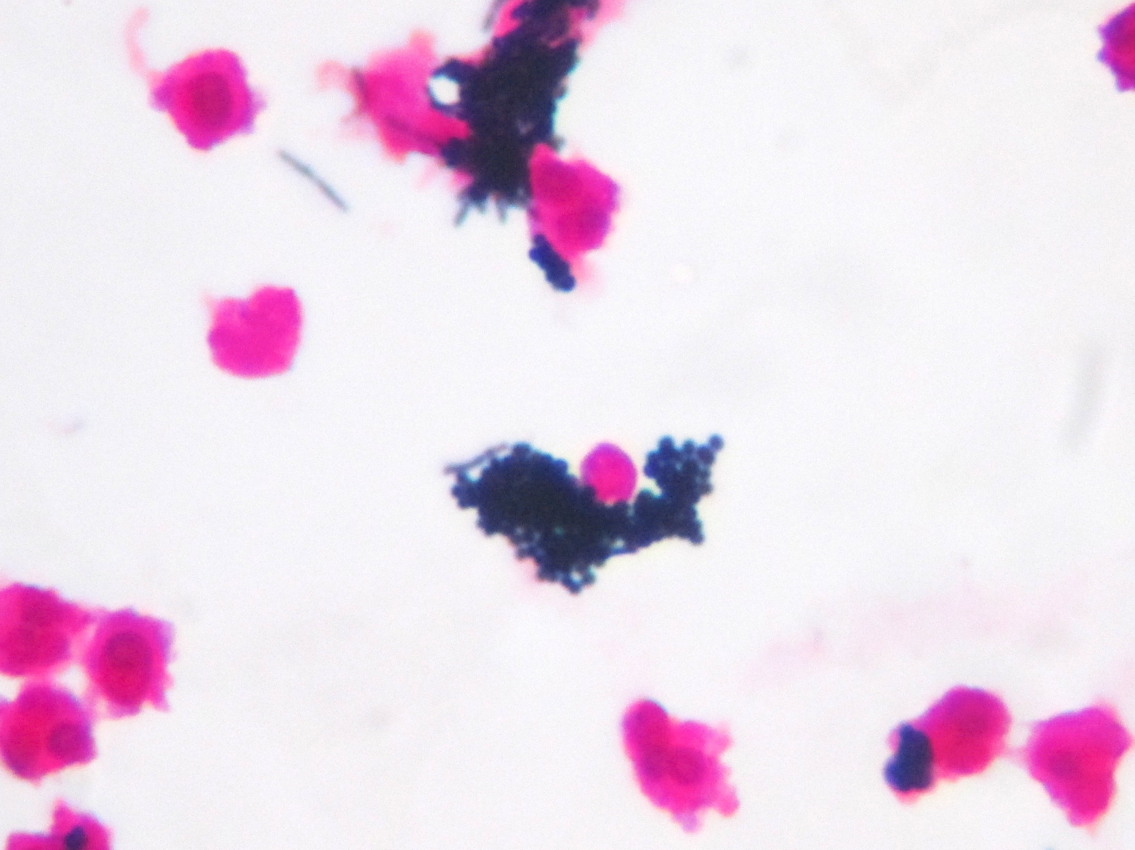 Staphylococcus saprophyticus〔腐性ブドウ球菌〕