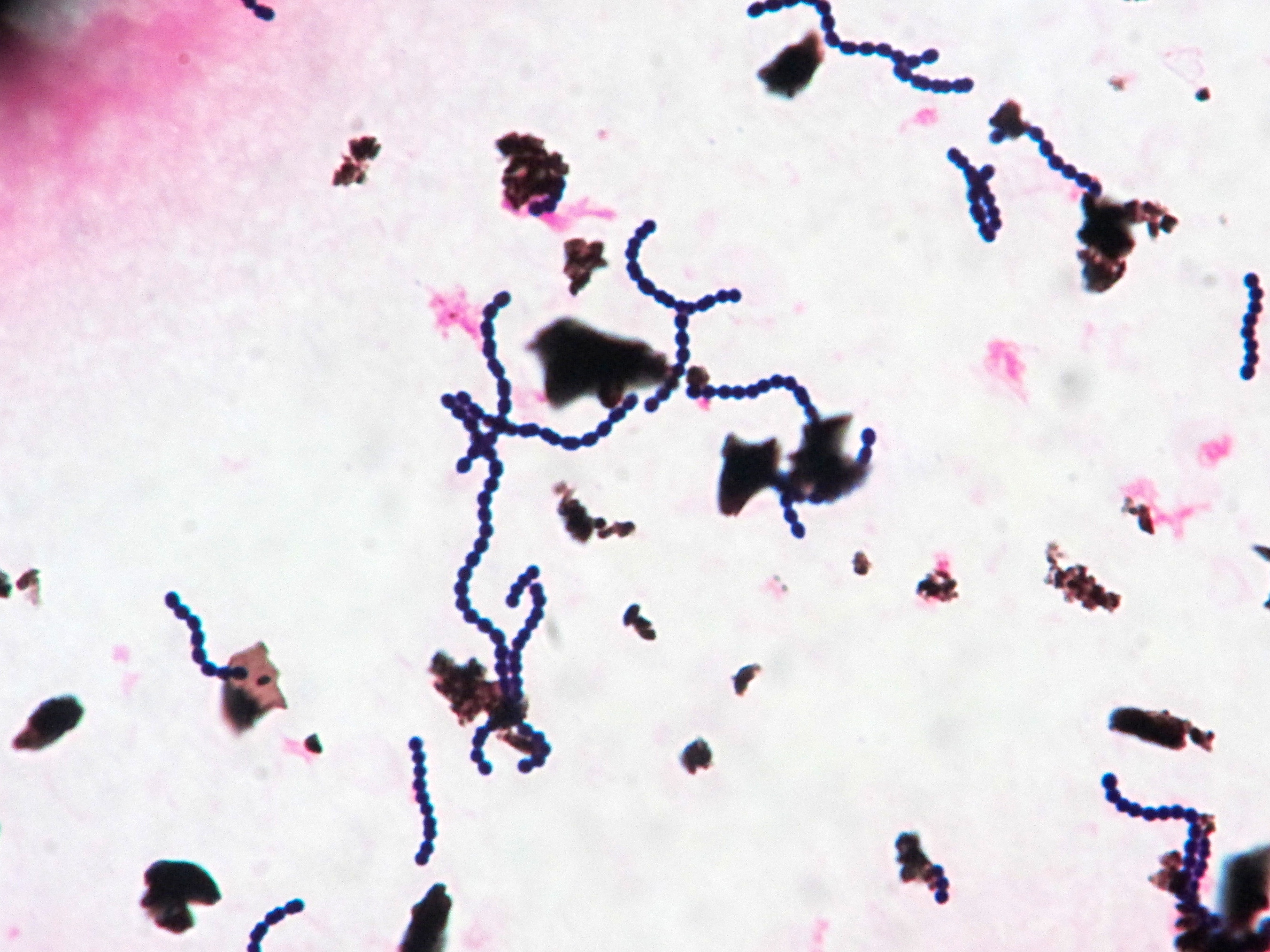 Streptococcus dysagalactiae