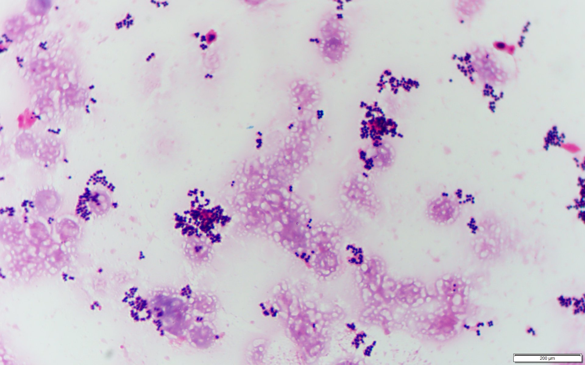 Staphylococcus aureus〔黄色ブドウ球菌〕