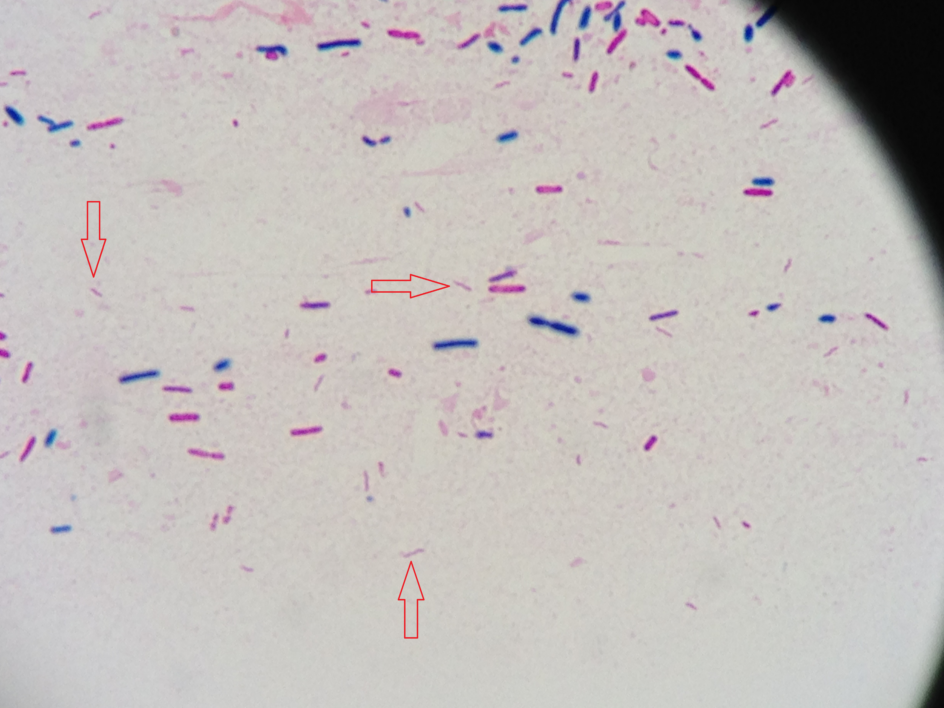 Campylobacter jejuni〔カンピロバクター〕