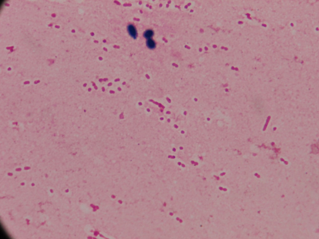 acinetobacter baumannii gram stain