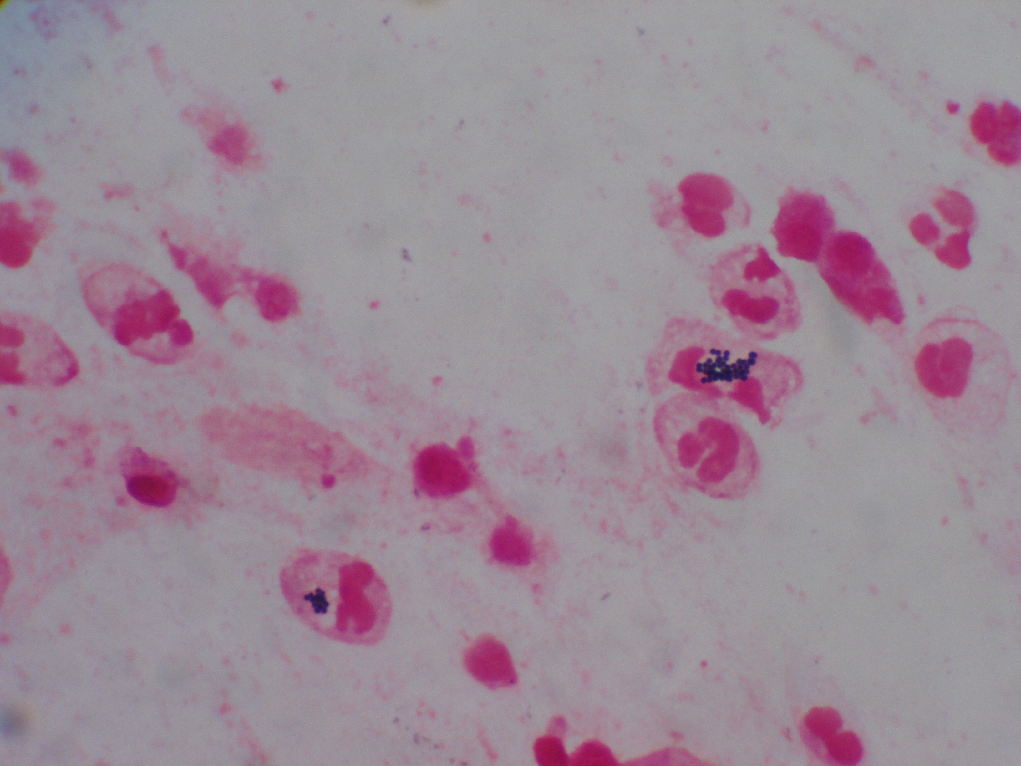Staphylococcus aureus 〔黄色ブドウ球菌〕