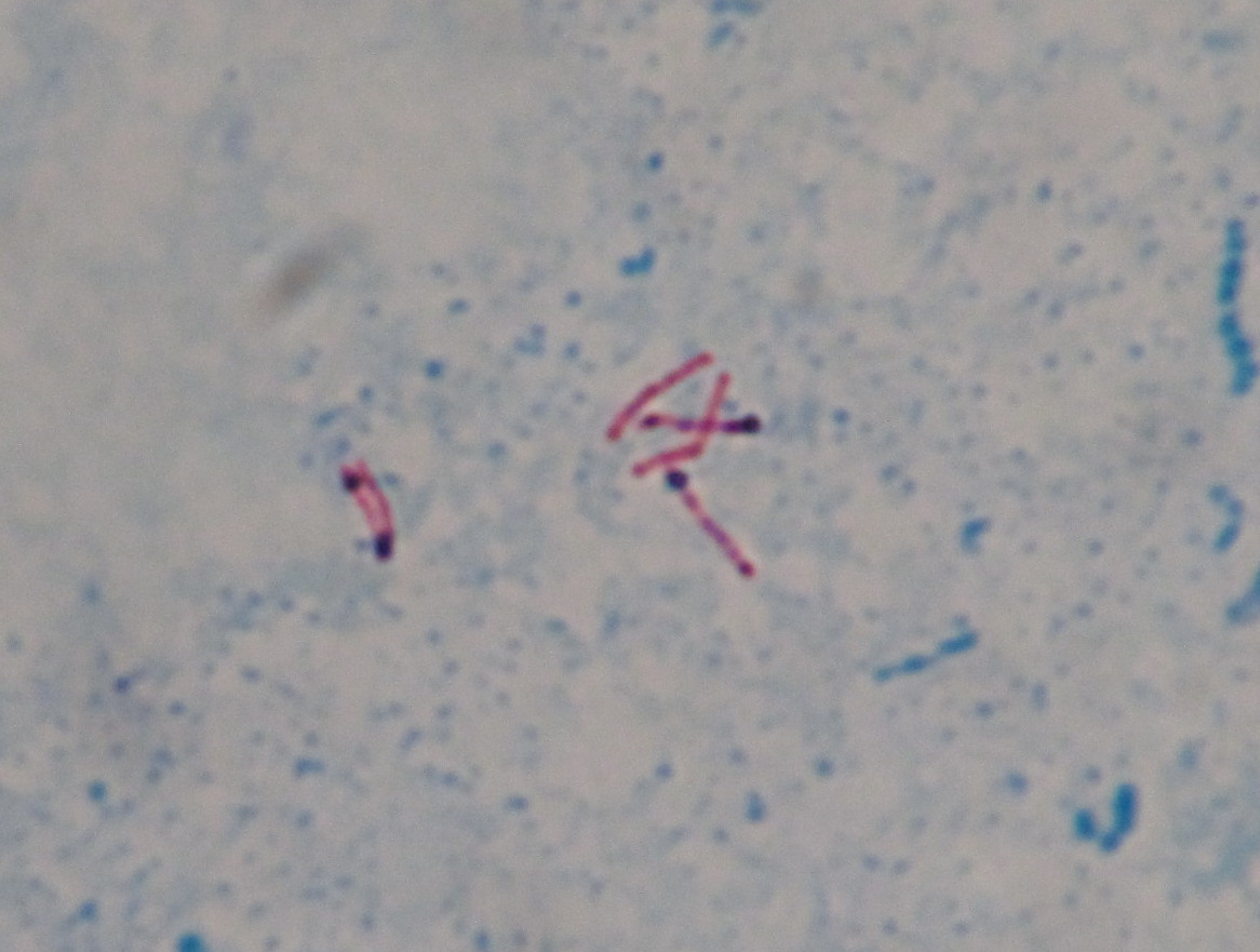 Mycobacterium tuberculosis〔結核菌〕