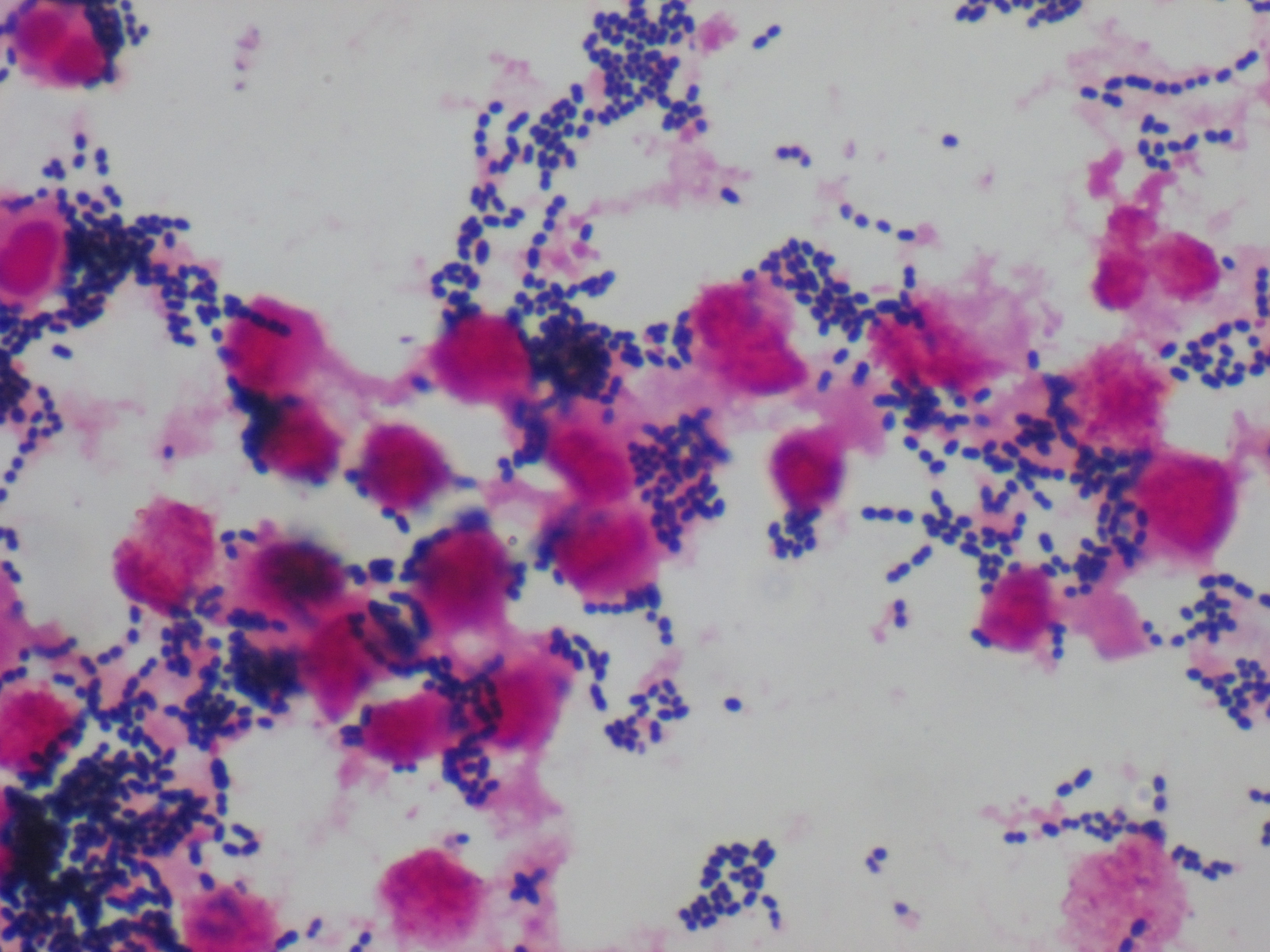 Enterococcus feacalis 〔腸球菌〕