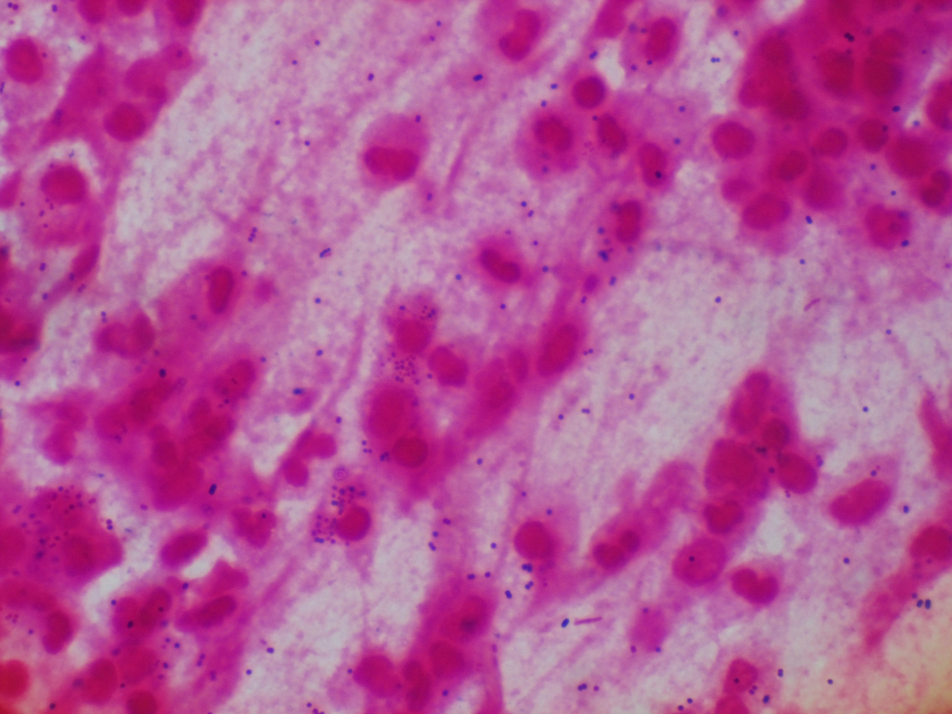 Moraxella catarrhalis 〔Pseudo GPDC〕 ニセモノ肺炎球菌