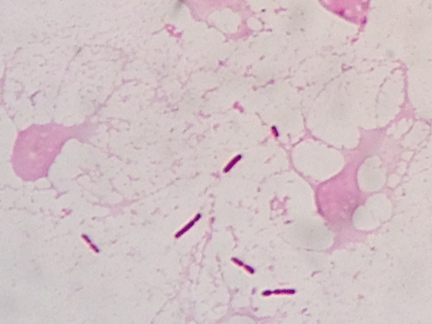 Bacteroides uniformis〔バクテロイデス属〕　嫌気性菌