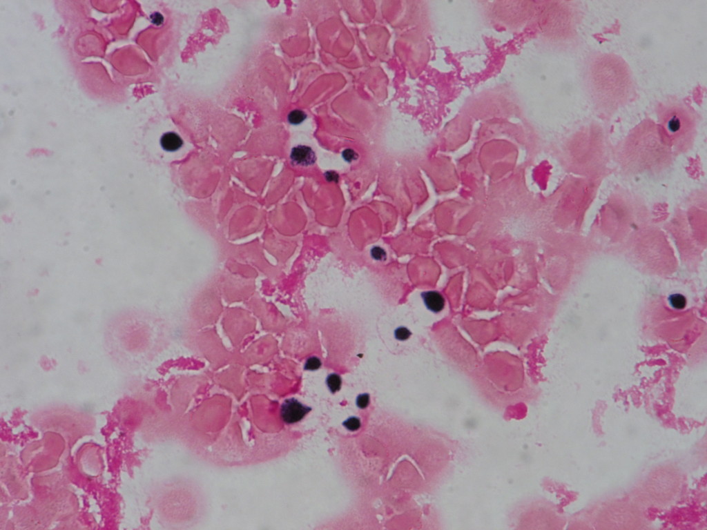 Cryptococcus neoformans　〔クリプトコッカス〕
