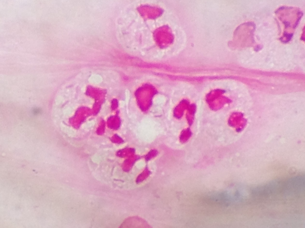 Pseudomonau aeruginosa〔緑膿菌〕