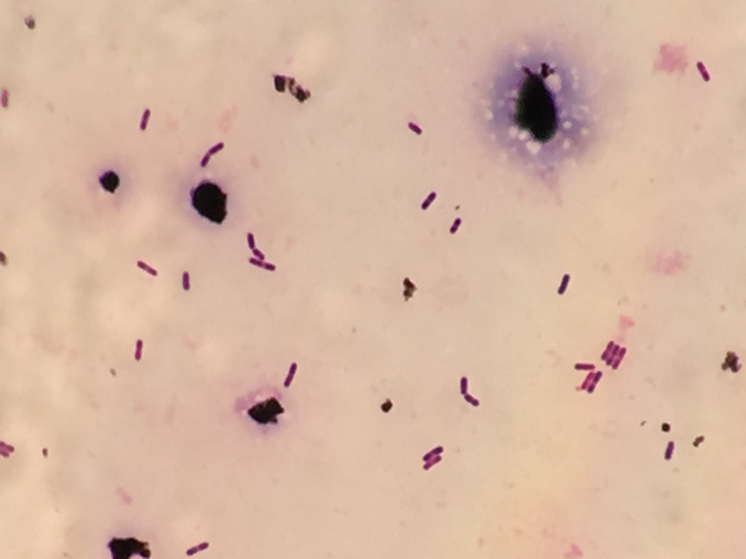 Listeria monocytogenes〔リステリア〕