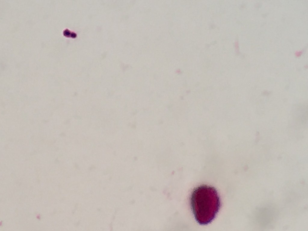Streptococcus pneumoniae〔肺炎球菌〕