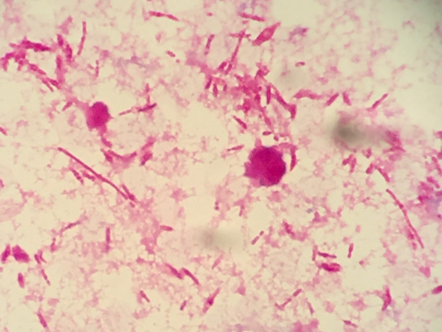 Bacteroides fragilis　〔嫌気性菌〕