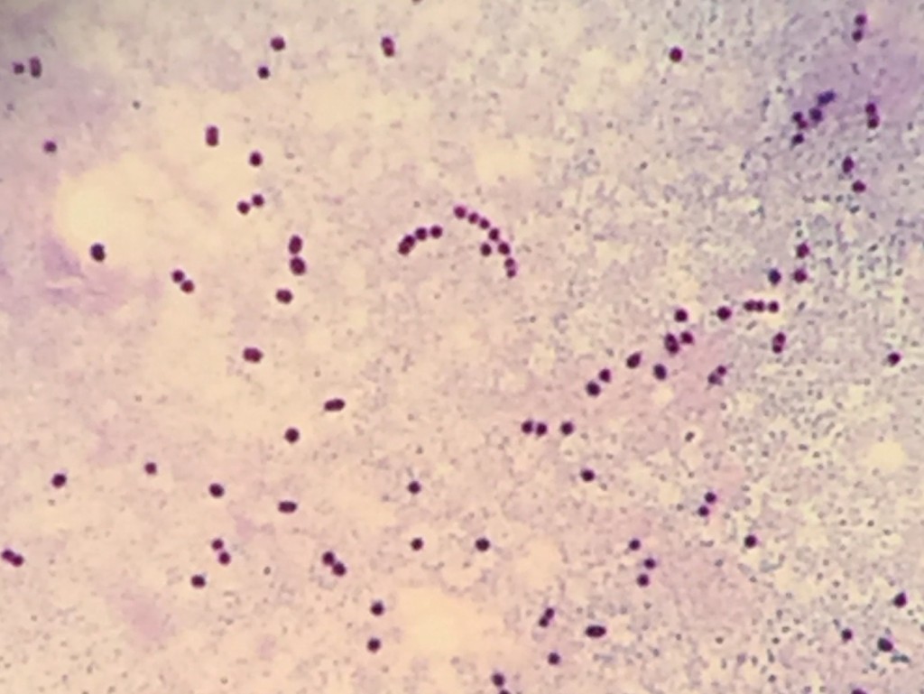 Streptococcus pyogenes　〔A群β溶連菌〕