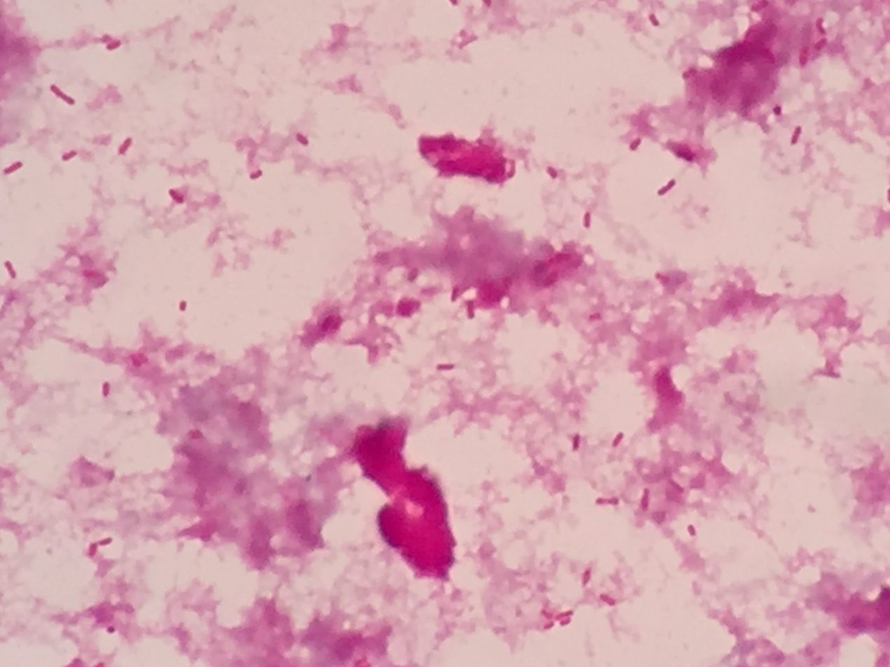 Elizabethkingia meningoseptica〔エリザベスキンギア〕 | グラム染色 ...