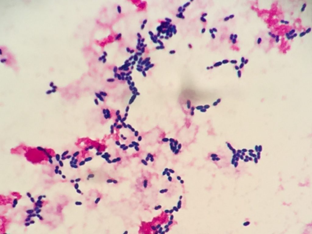 Streptococcus gallolyticus〔連鎖球菌〕