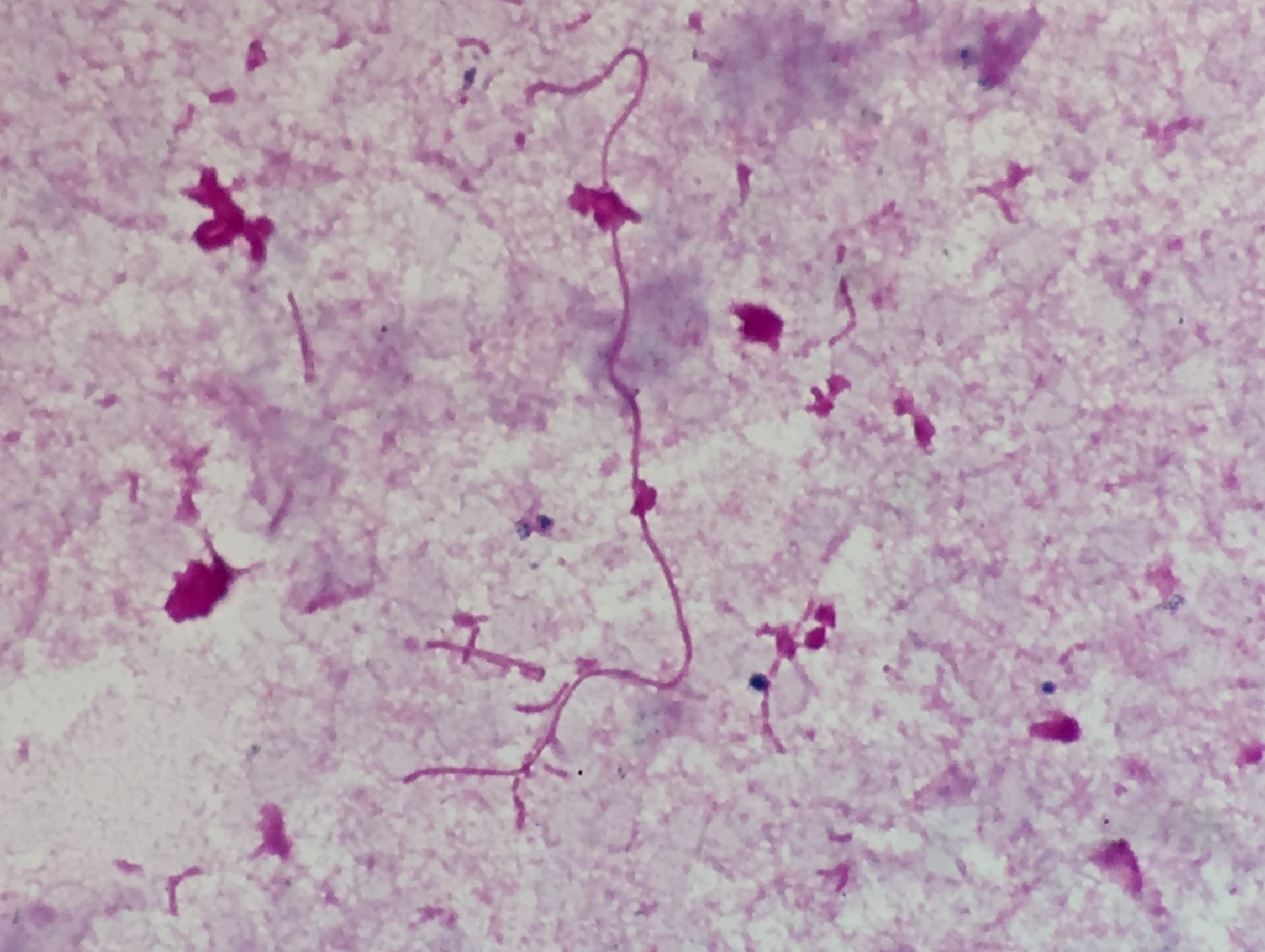 Fusobacterium necrophorum〔壊死桿菌〕