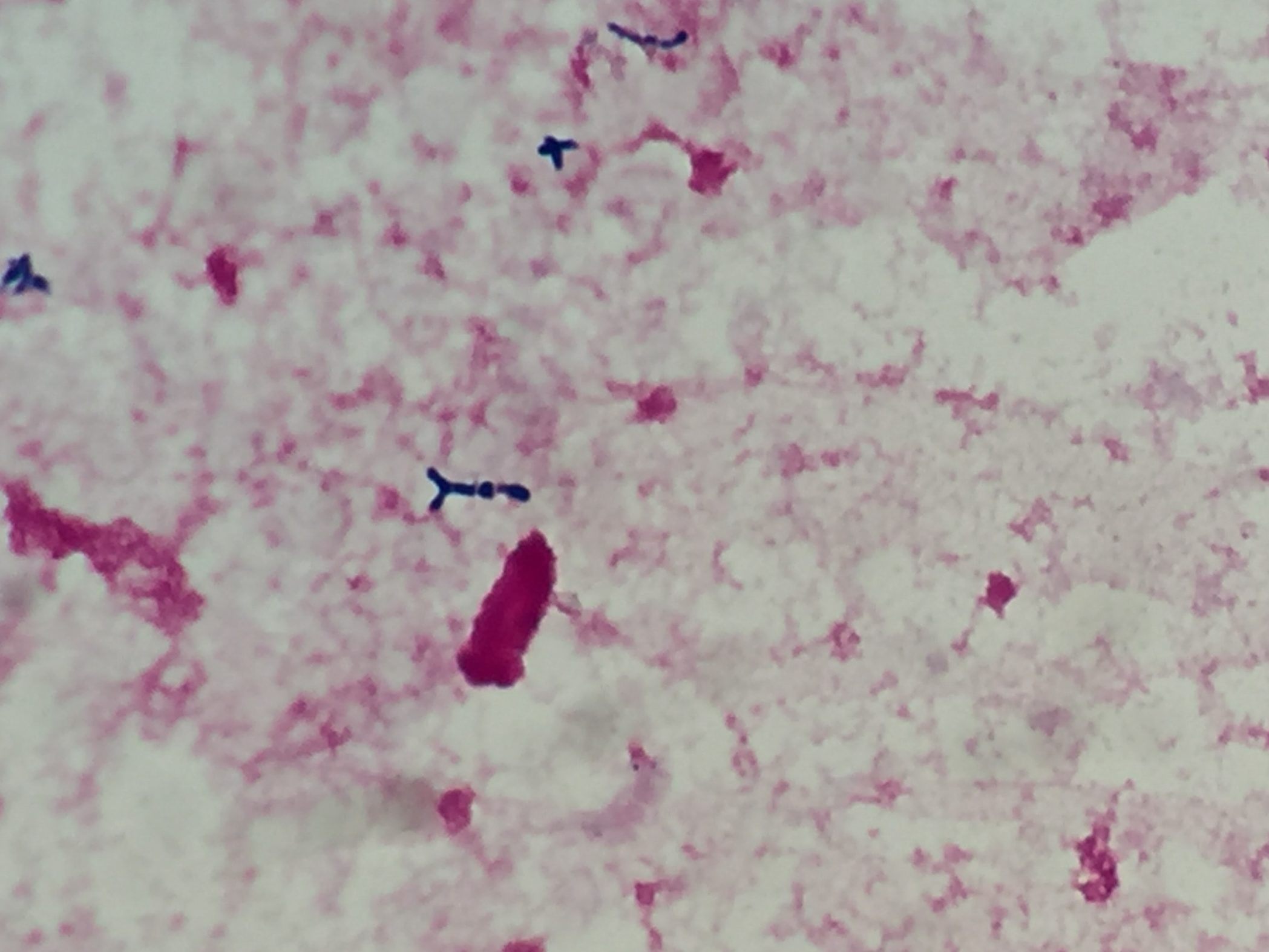 Bifidobacterium breve〔ビフィドバクテリウム〕