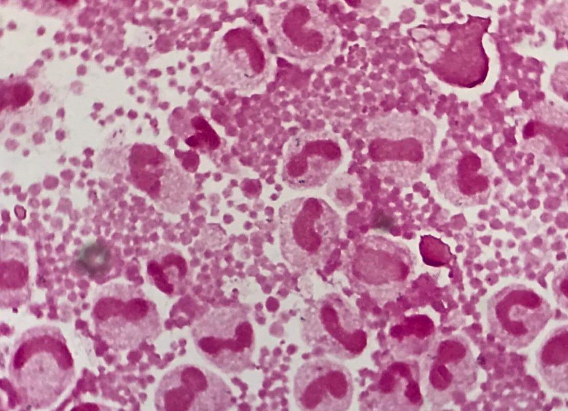 Streptococcus pneumoniae〔肺炎球菌〕