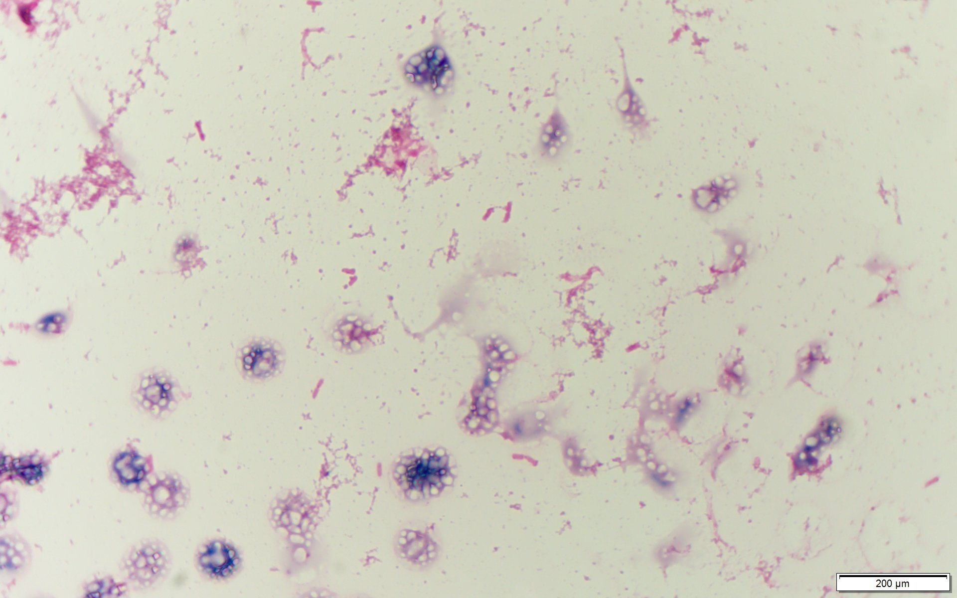 Salmonella enterica serovar Paratyphi〔パラチフス〕