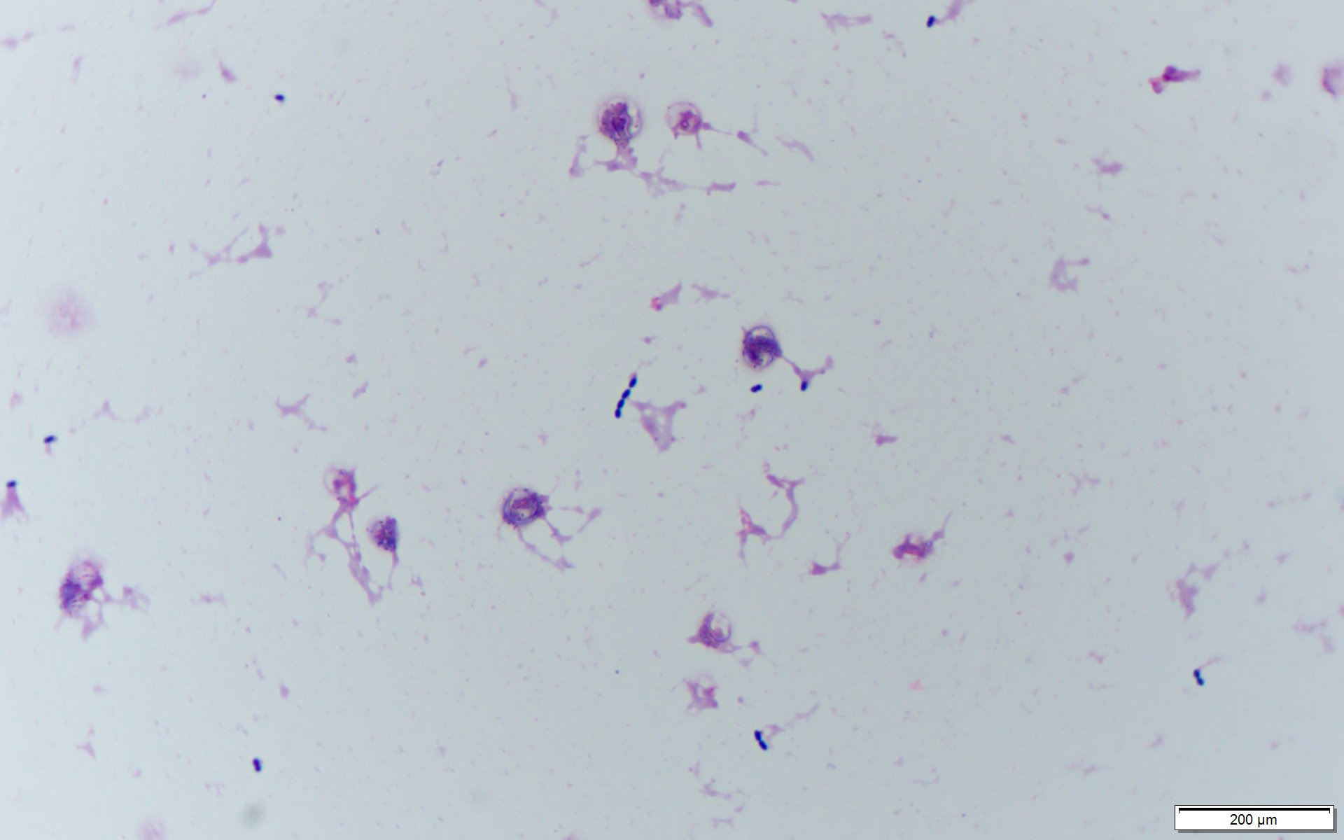 Enterococcus avium〔レア腸球菌〕
