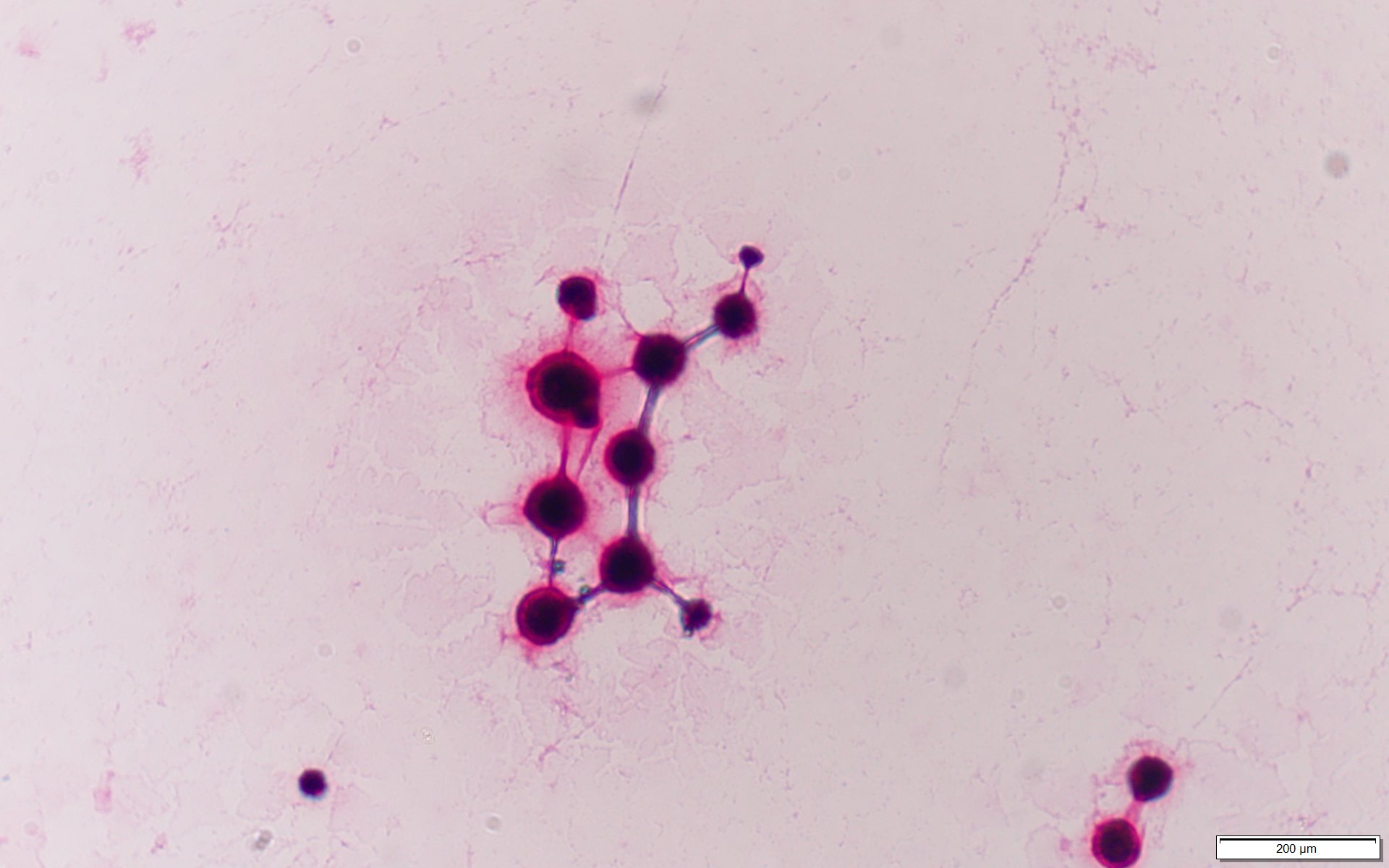 Cryptococcus neoformans〔クリプトコッカス〕