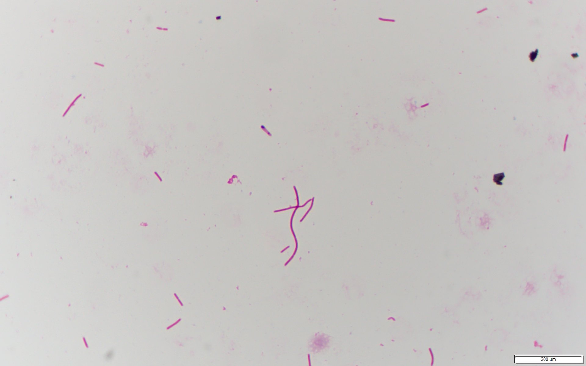 Clostridium tertium〔酸素耐性嫌気性菌〕