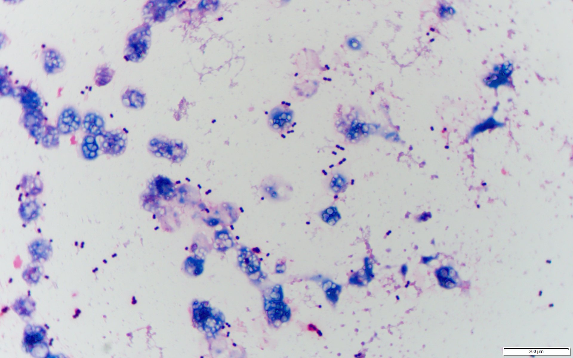 肺炎球菌：ムコイド型〔Streptococcus pneumoniae〕