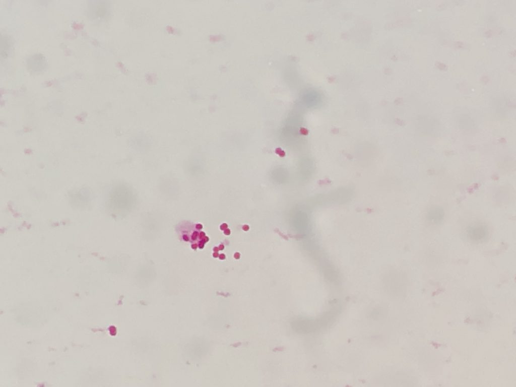 Neisseria menigitidis〔髄膜炎菌〕
