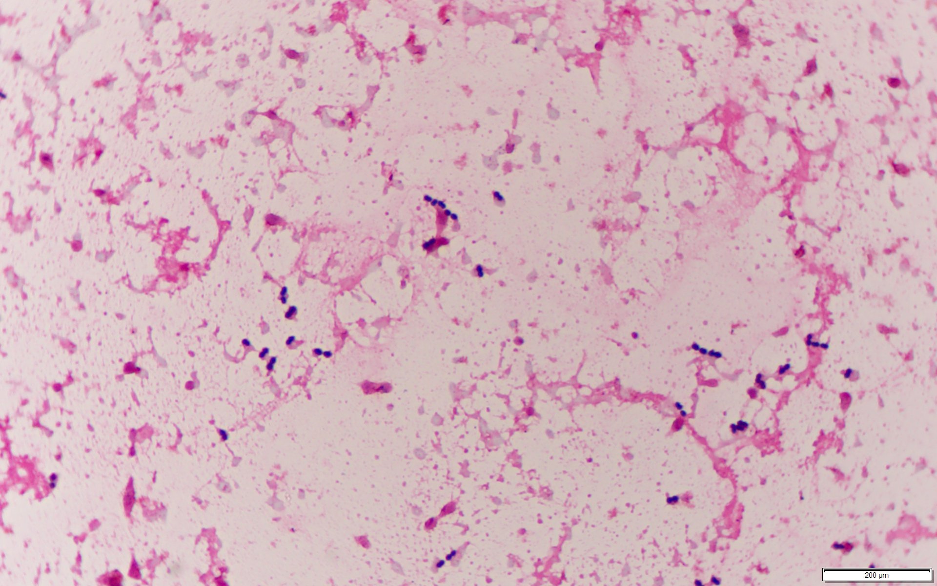 Enterococcus casseliflavus〔黄色い腸球菌〕